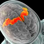 Vědci dešifrují myšlenky pomocí čipů v mozku