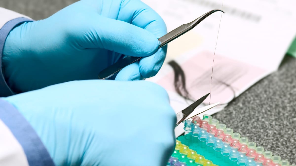 Mohou být účinnější terapie rakoviny? Vědci čtou biologický rytmus z vlasového vzorku