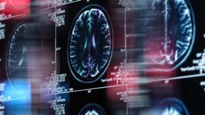 Funkce mozkových skenů v odhalování rozporů v morálním jednání