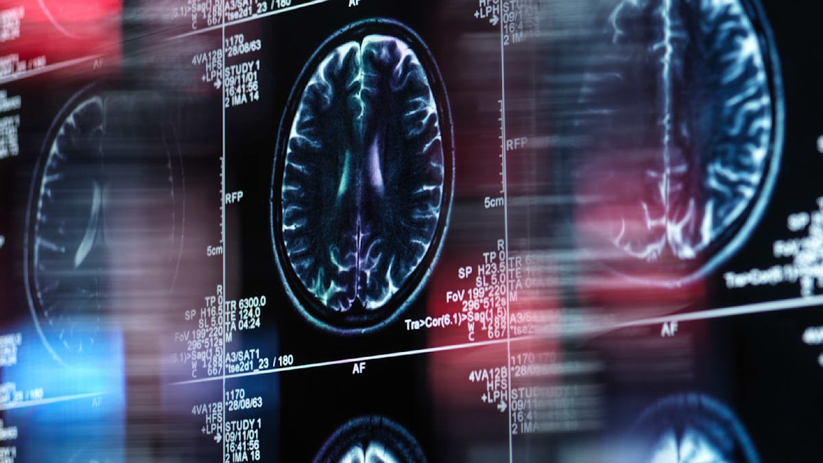 Funkce mozkových skenů v odhalování rozporů v morálním jednání